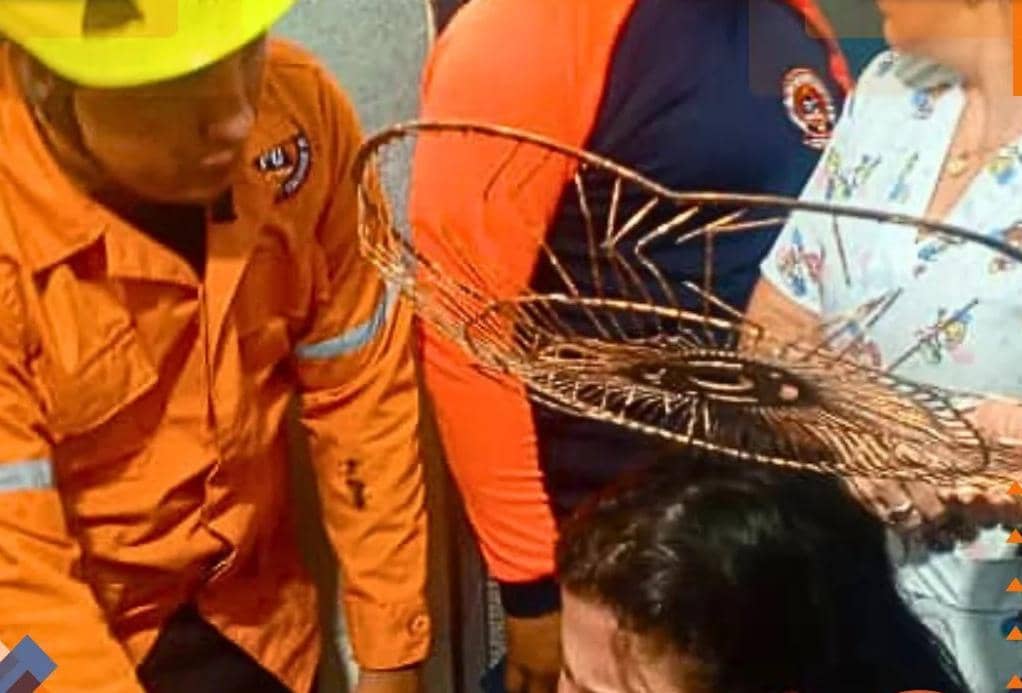Rejilla de un ventilador cae y lesiona en la cabeza a una mujer