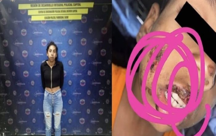 Detienen a mujer que quemó a su hijo con una cuchara caliente