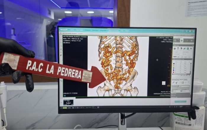 Incautan más de un kilo de cocaína oculto de manera intraorgánica en el Táchira