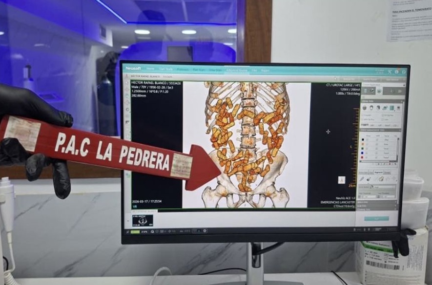 Incautan más de un kilo de cocaína oculto de manera intraorgánica en el Táchira