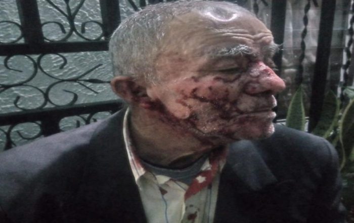 Táchira: Perro ataca un adulto mayor y casi lo mata