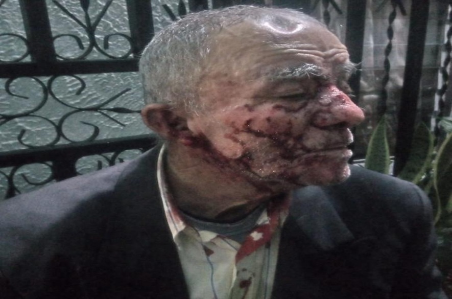 Táchira: Perro ataca un adulto mayor y casi lo mata